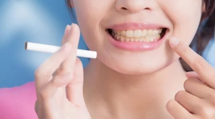Smoking ways How to prevent dentist from knowing you smoke