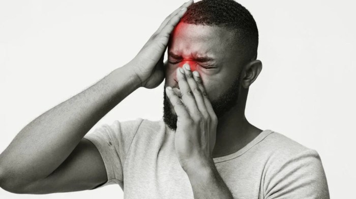 Sinusitis Sinusitis