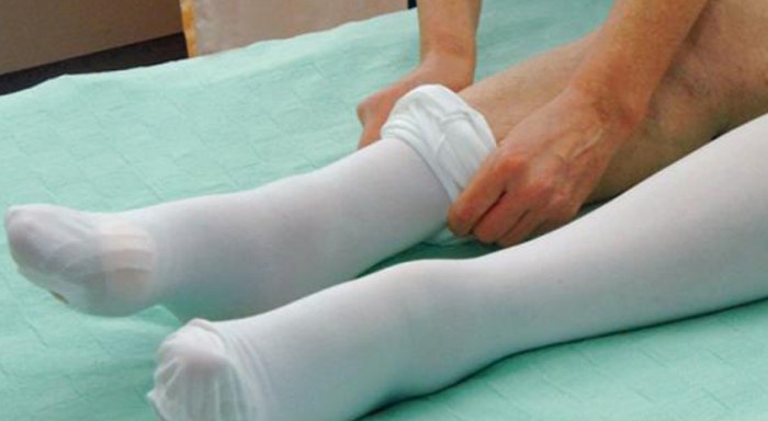 How long to wear compression socks after knee surgery