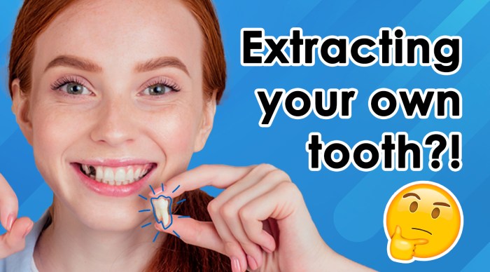 How one can Pull a Cracked Tooth A Information